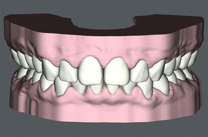 Preventative Dentistry Technology