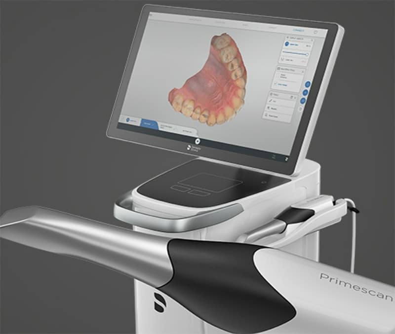 Intraoral scanner dental clinic