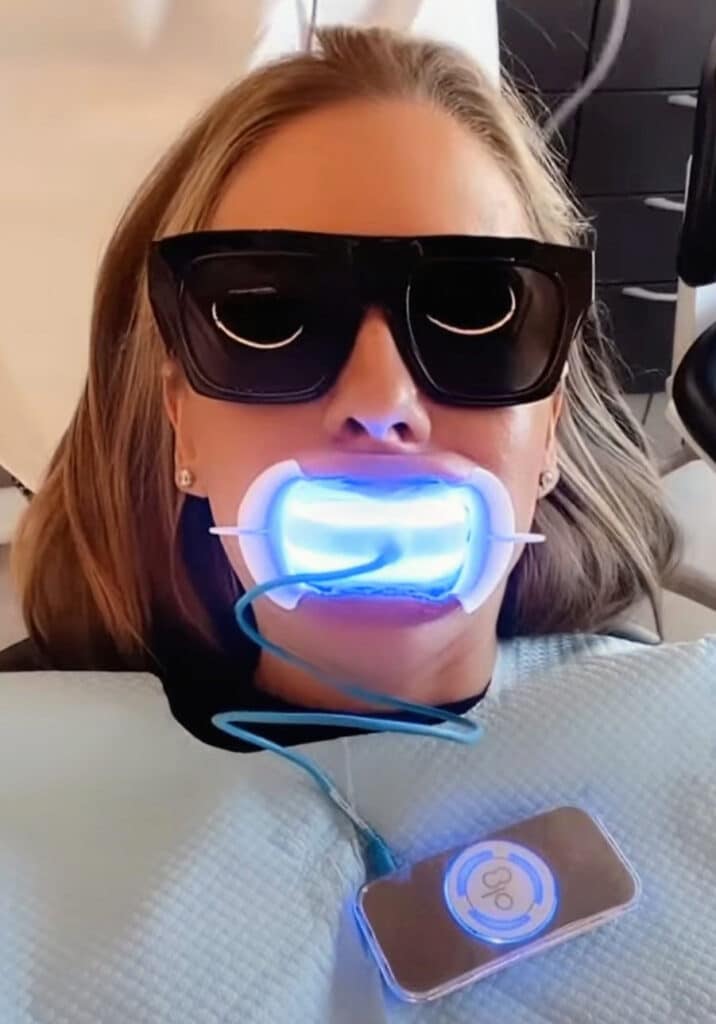 Teeth Whitening Best Modern Techniques