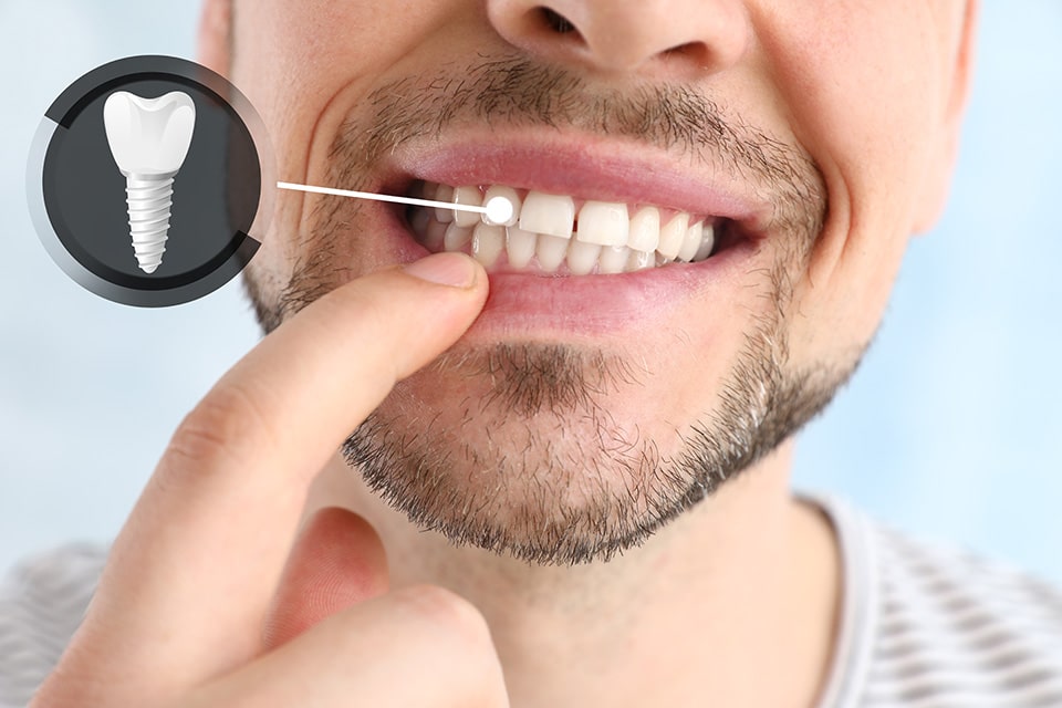 restorative dentistry results