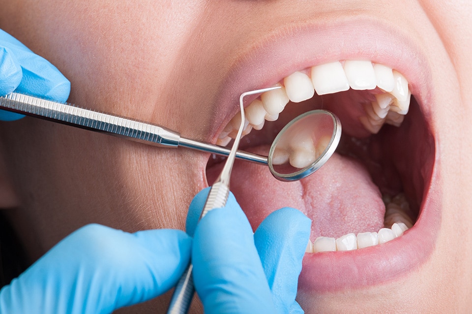 root canal treatment to improve dental health
