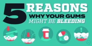 5 Reasons Why Your Gums Might be bleeding